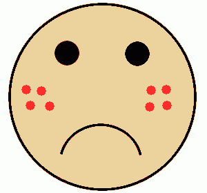 acne_cartoon_face