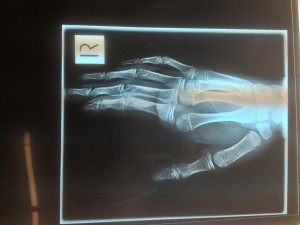 handmcdllat