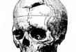 Phineas_gage_-_1868_skull_diagram